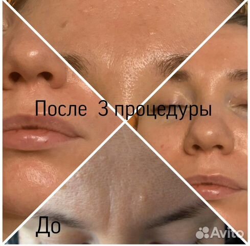 Массаж. Скульптурный массаж лица. Все виды массажа