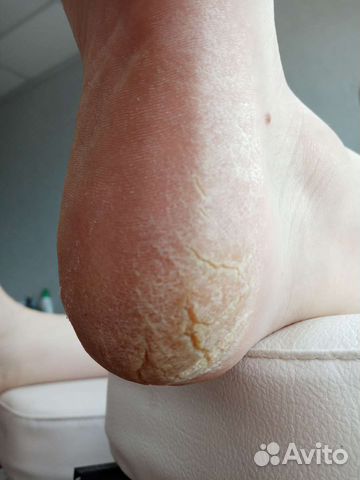 Услуги подолога